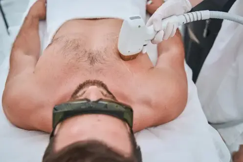 chest hair removal